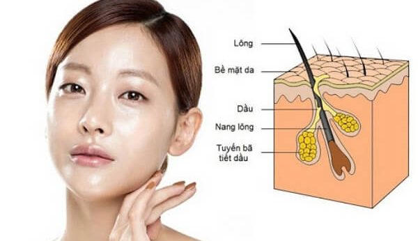 Cách điều trị da mặt nhờn hiệu quả